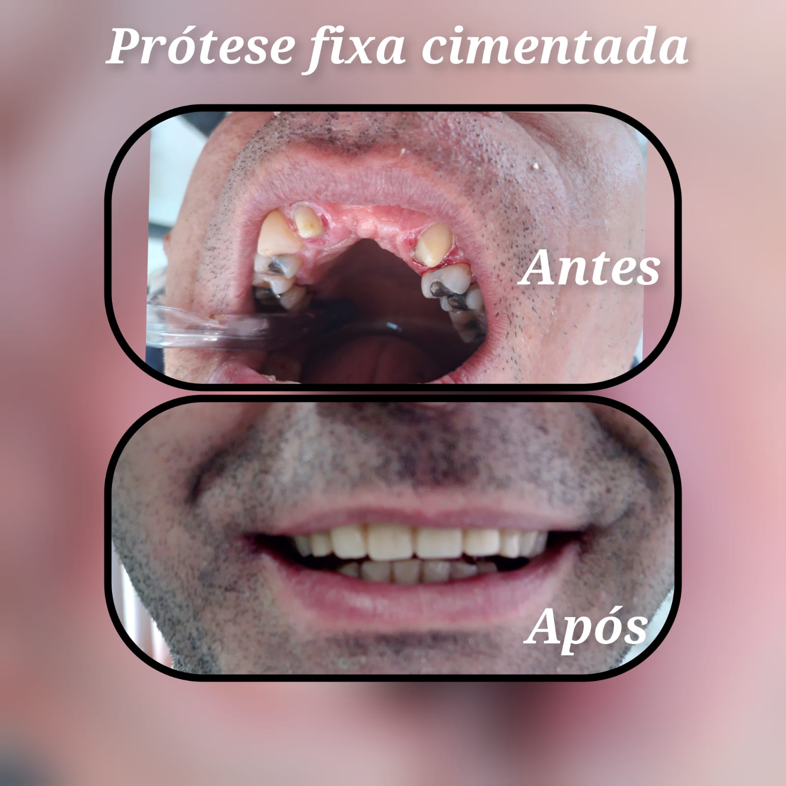 Resultado 7